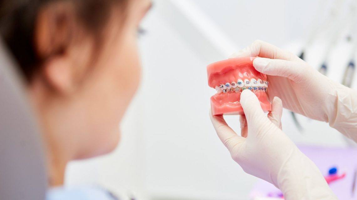 Quanto è importante l'apparecchio per i denti ai bambini?